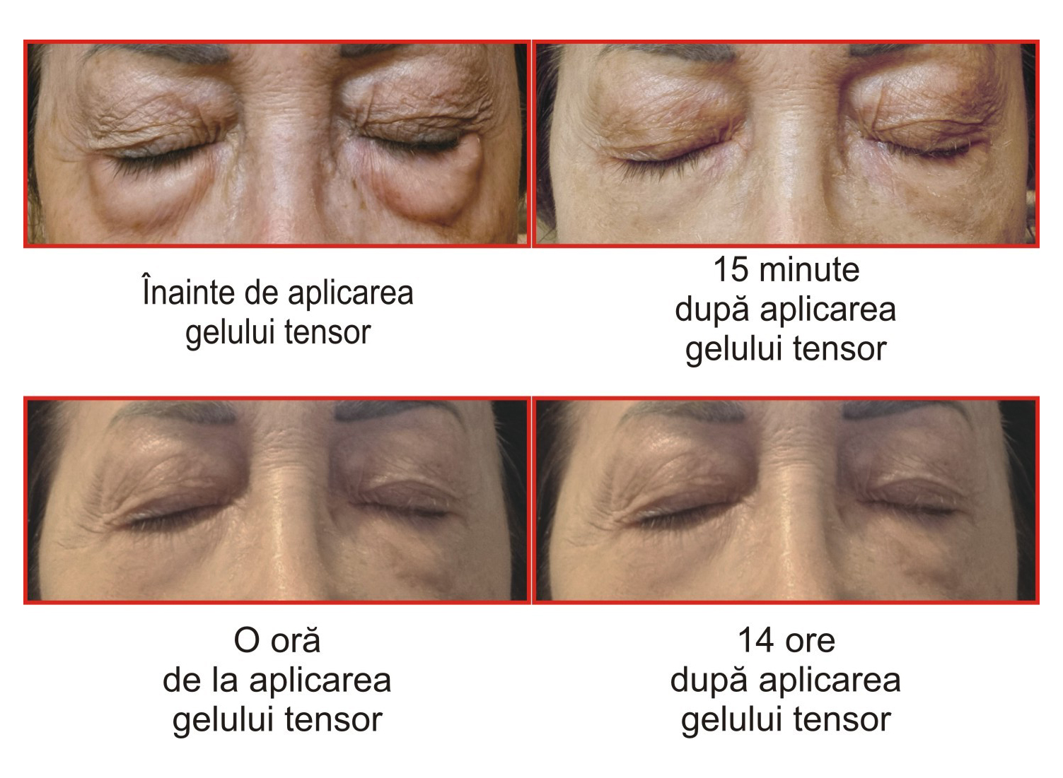 Before & After gel Tensor Herbagen