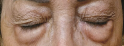 aplicare-1