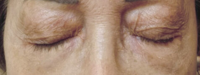 aplicare-2